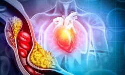 Kötü kolesterolü düşüren beslenme önerileri: Sağlıklı kalbin anahtarı doğru gıdalarda