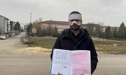 “Kaynar Çayı Yüzüme Fırlattı”