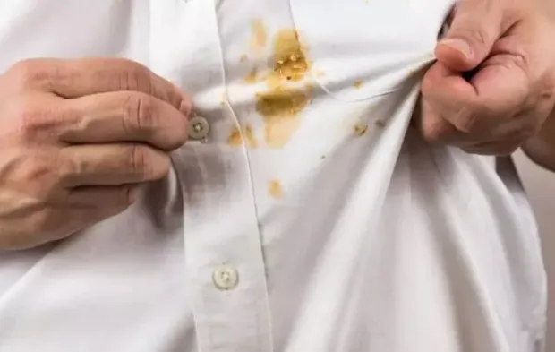 Kimse Bilmiyor Ama Çözümü Mutfakta: Kurumuş Yağ Lekesini Bile Yok Ediyor