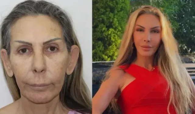 Petek Dinçöz'den sonra annesi de estetik ameliyat oldu: Son hali şaşırttı