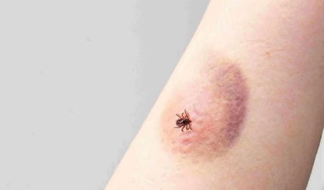 Havalar ısındı alarm verildi: Ölümcül virüs taşıyan tehlike geri döndü