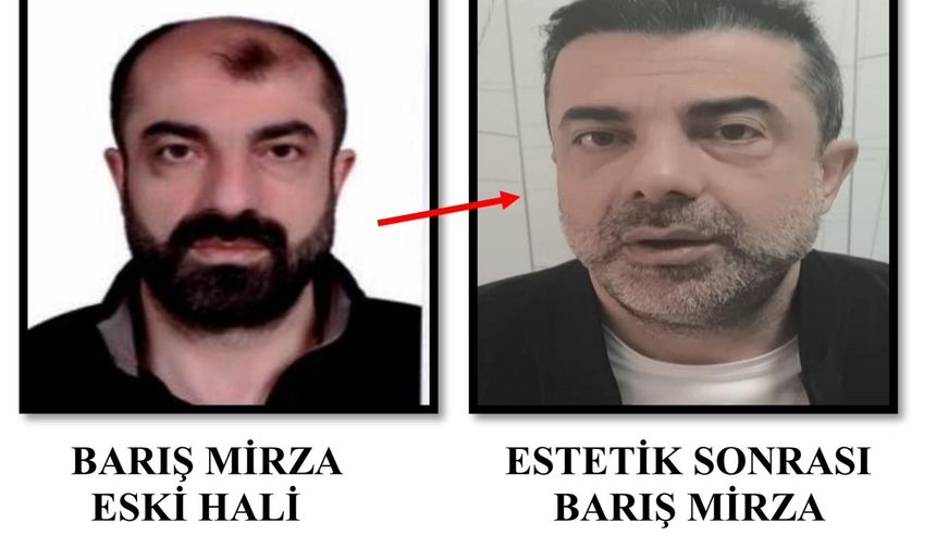 Ameliyat ile yüzünü değiştiren firari cinayet zanlısı, 7 yıl sonra yakalandı