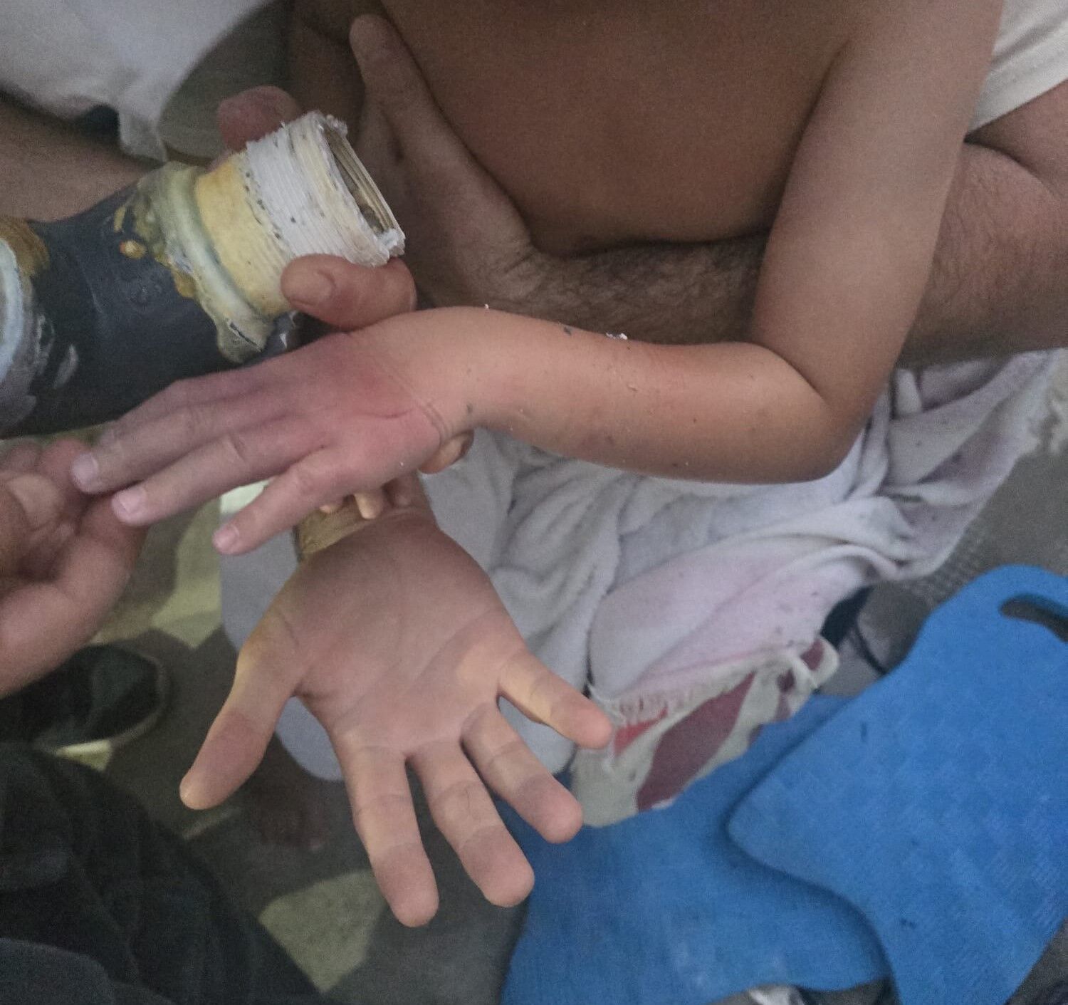 Muğla'da Havuzun Emiş Borusuna Sıkışan Çocuk Kurtarıldı (1)